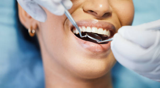 Best Emergency Treatment for Oral Infections in Macon, MS